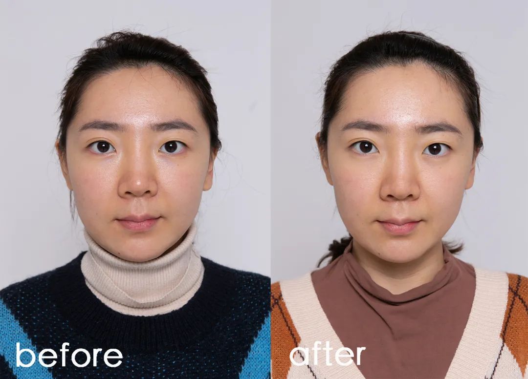 当人衰老了会出现什么变化,当身体衰老会出现哪几种现象