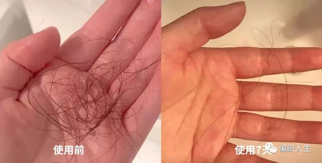 德国老太太用什么洗发水,93岁德国老太太