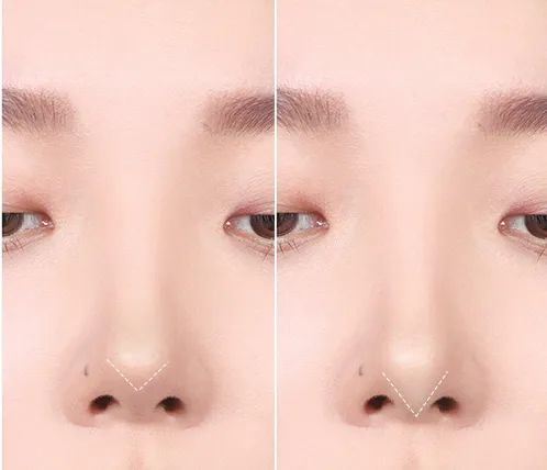 0成本赚钱快,0成本0基础赚钱