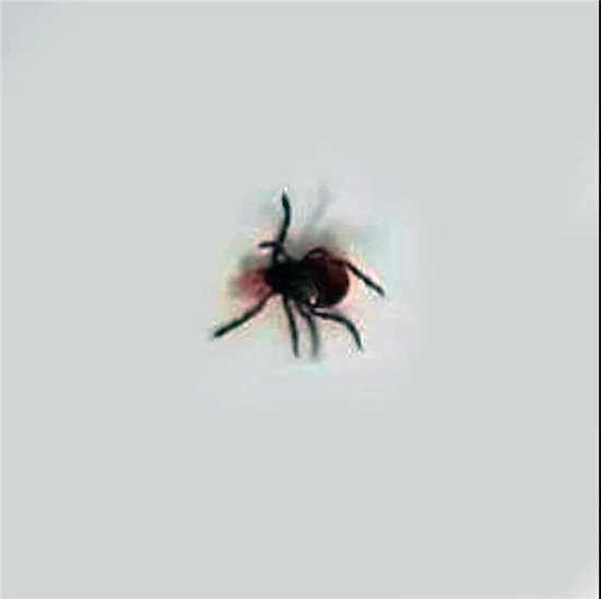 惊险！唐山妇幼耳鼻喉科一天收治7例异物患者