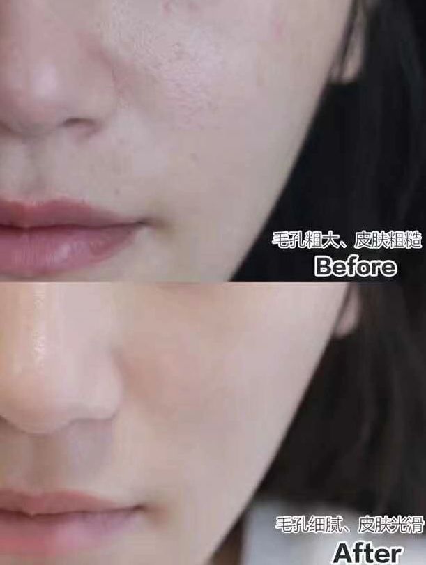 不整容不医美人真的会变吗,不整容不化妆变成美女