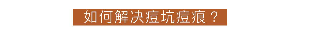 黑头痘印怎么去除,黑头痘印怎么消除学生党