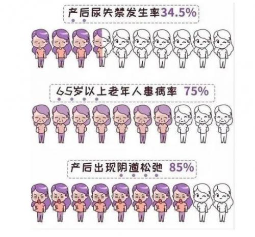 大笑咳嗽会流尿咋办,大笑咳嗽漏尿做什么手术