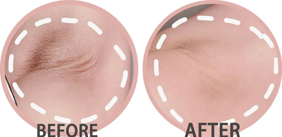 无痛搓泥|日系变态搓澡巾！轻轻搓一搓，泥条劈里啪啦的掉