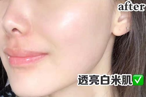 长期补充胶原蛋白的人怎么样了,长期喝胶原蛋白的人最后怎么样了