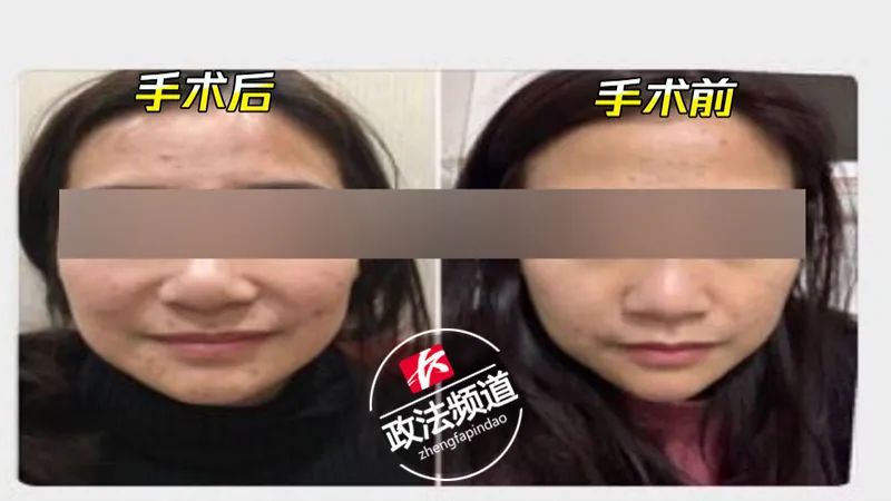 23岁女子整容失败遗书,爱美也需要理智
