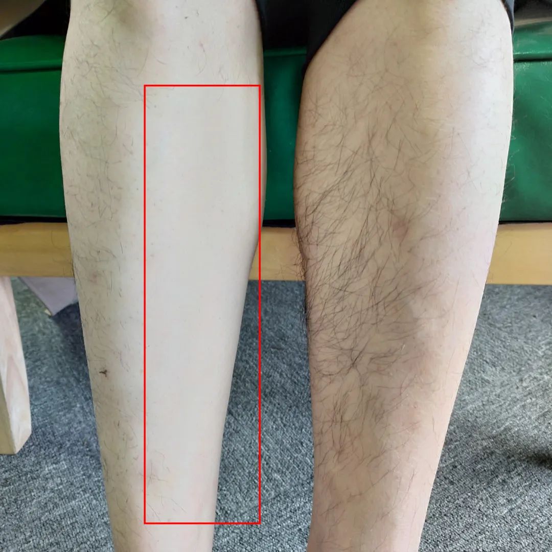 光滑无暇|黑丑的“毛裤腿”，用它，10分钟“脱”得一干二净，肌肤光滑细腻