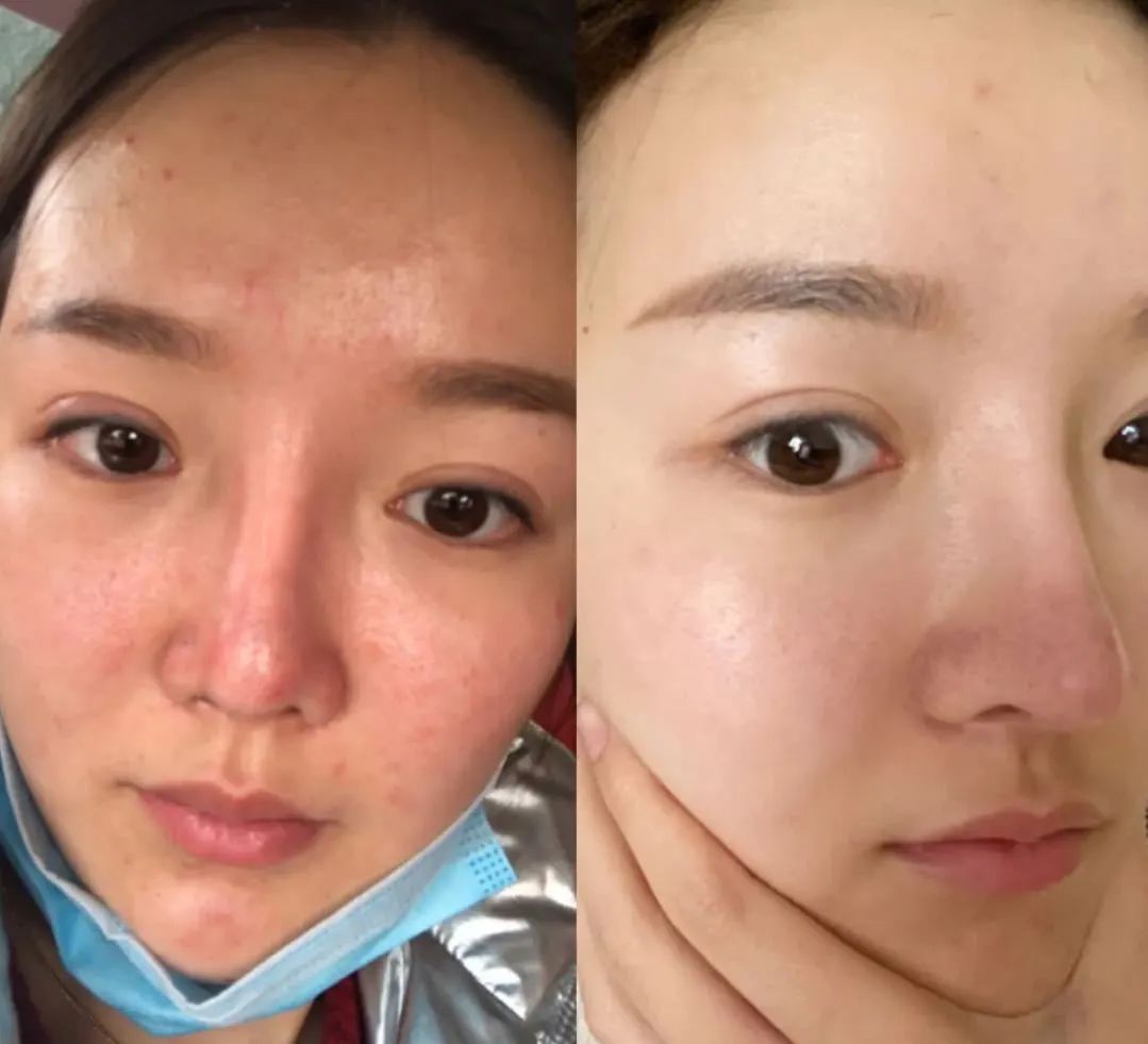 洗出脸上的脏东西解压,清除脸上斑块的产品