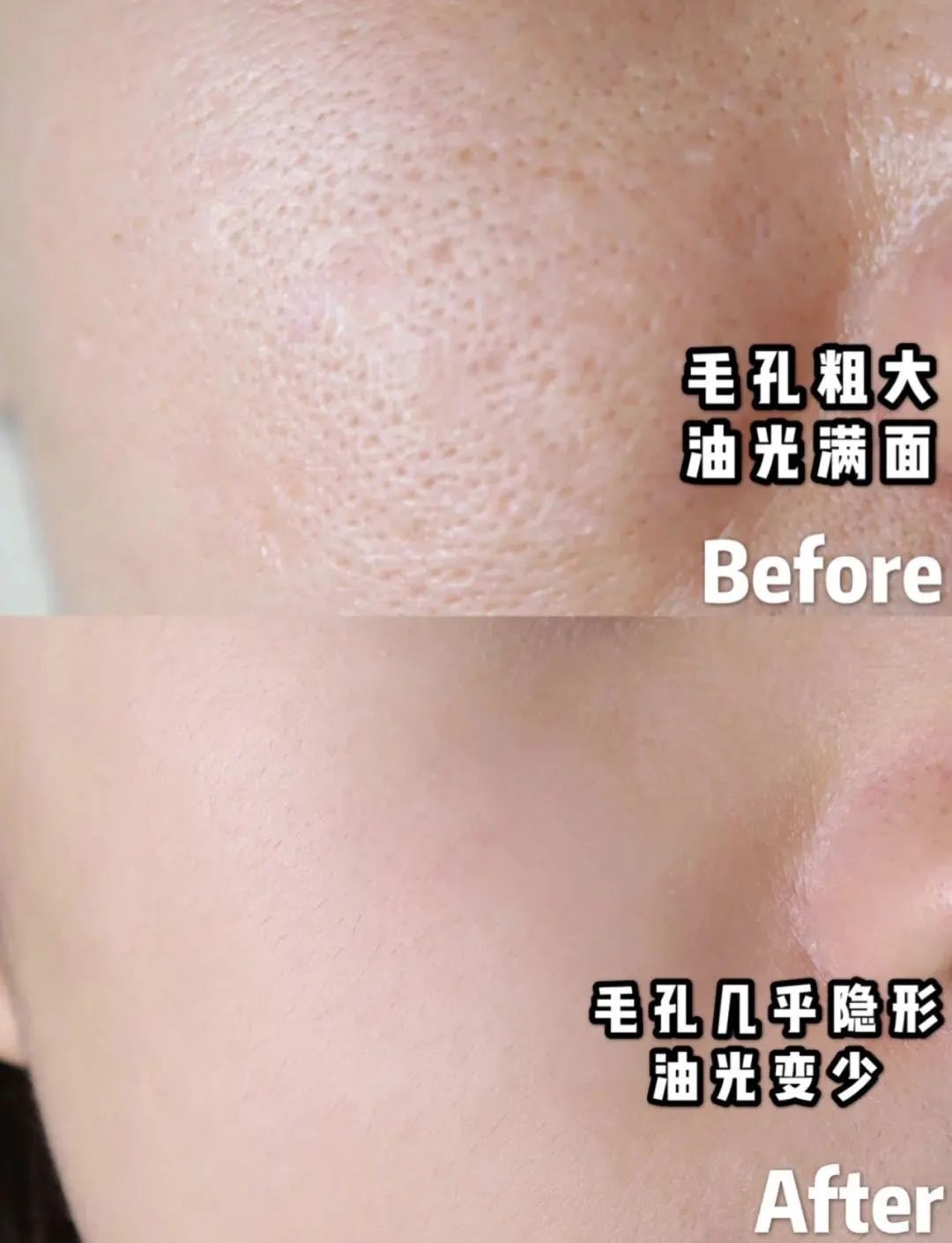 洗出脸上的脏东西解压,清除脸上斑块的产品