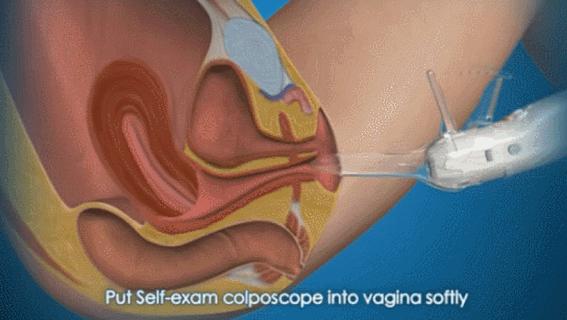 盘点医院各大科室侵入性检查：穿刺、内镜各显神通，小活检标本以“小”见“大”