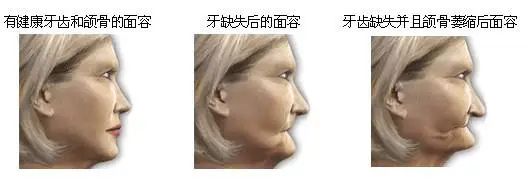 昆明独生子父母可以领补贴吗,昆明怎么领取补贴