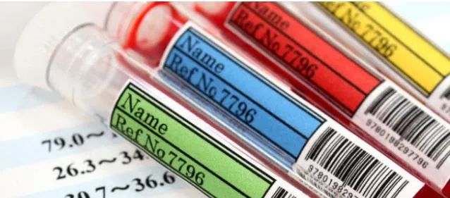 nt-probnp值过高会怎样,pro-bnp升高一定是心衰吗