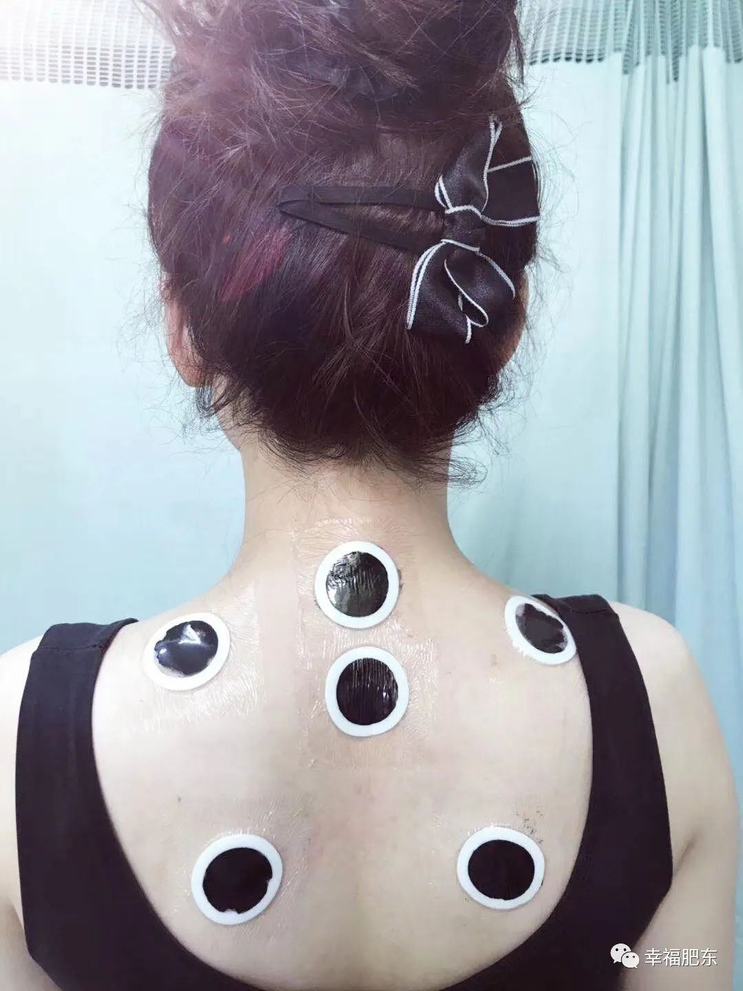 合肥再添一所三甲医院,肥东县中医院冬病夏治