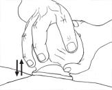 拔罐有几种拔罐方法,拔罐技巧视频大全