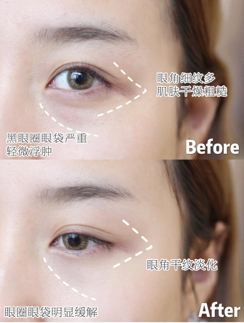 lamer海蓝之谜面霜团购,lamer海蓝之谜2023面霜多少钱