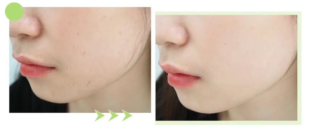 蜜诗肌酵素去角质凝胶,蜜诗肌酵素去角质