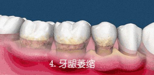 拯救牙黄牙黑口臭的看过来,黄牙黑牙有救了