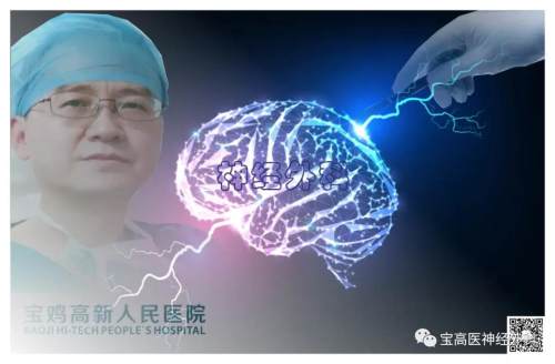 宝鸡高新医院唐宗椿,西安高新医院神经外科专家排名