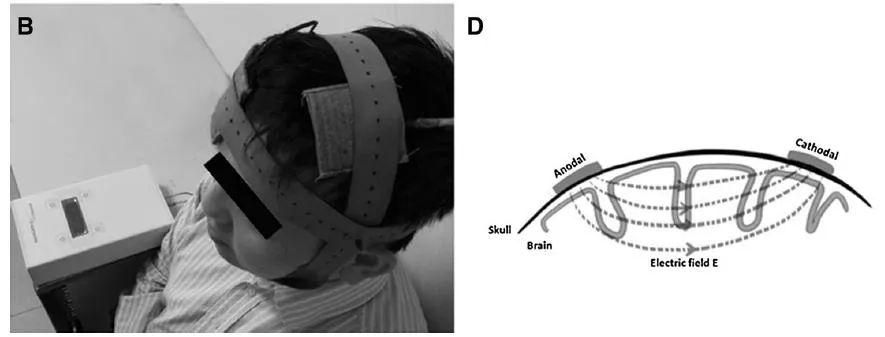 给大脑充电和开窍,对大脑充电的冷知识