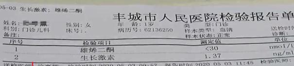 一侧乳房发育疼痛是真早熟吗,女宝宝假性乳腺发育是早熟吗