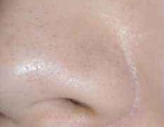 清洁毛孔黑头粉刺吸尘器,doco超微小气泡毛孔吸尘器直播