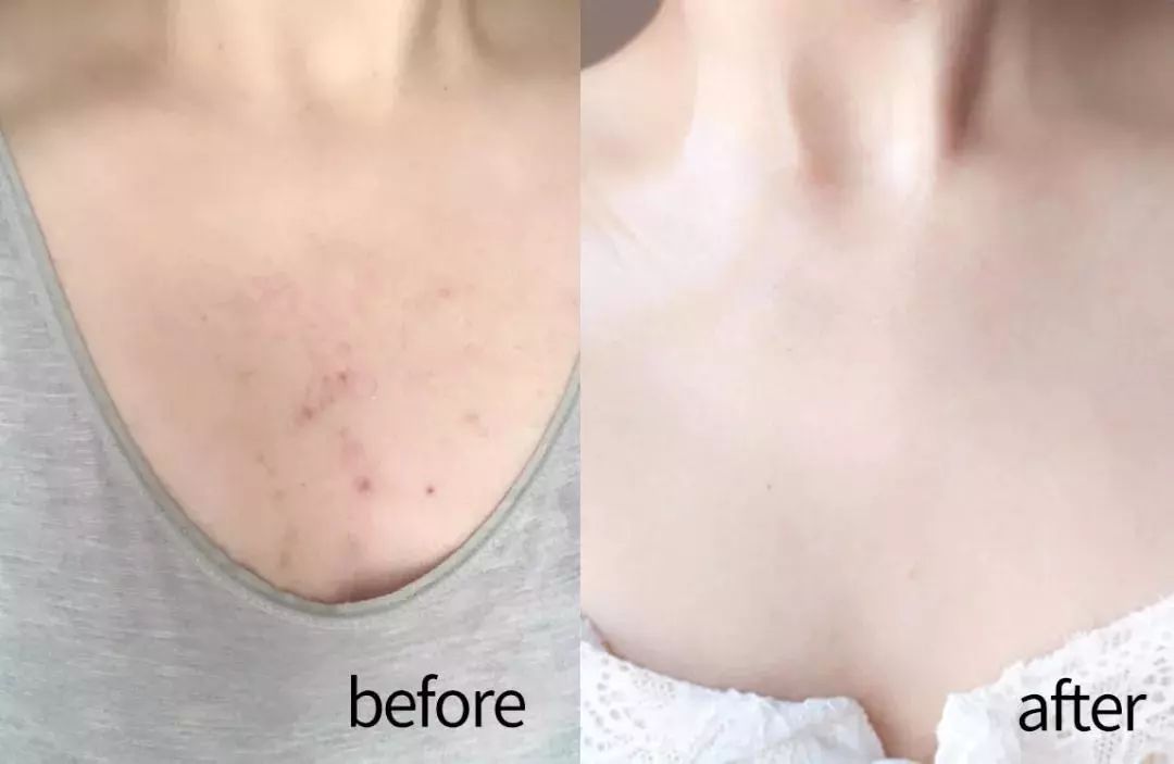 御寒神器保暖加绒背心,抗寒保暖防风背心