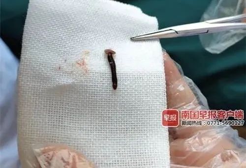 小孩骑ofo被撞死家长索赔80万,未满12岁男孩骑ofo身亡详情