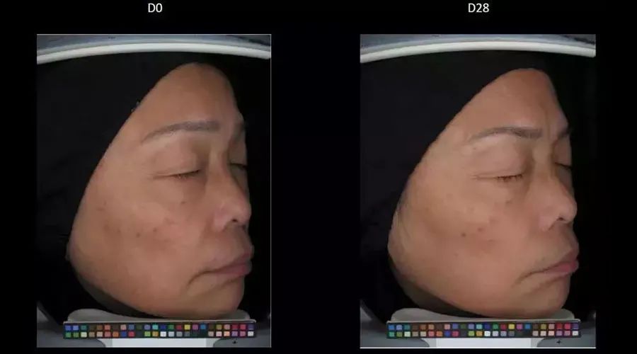 女生变白的正确方式,女生想要变白到底有多简单