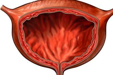插尿管后为什么会觉得尿急,儿童拔了尿管后疼痛而且尿意频繁