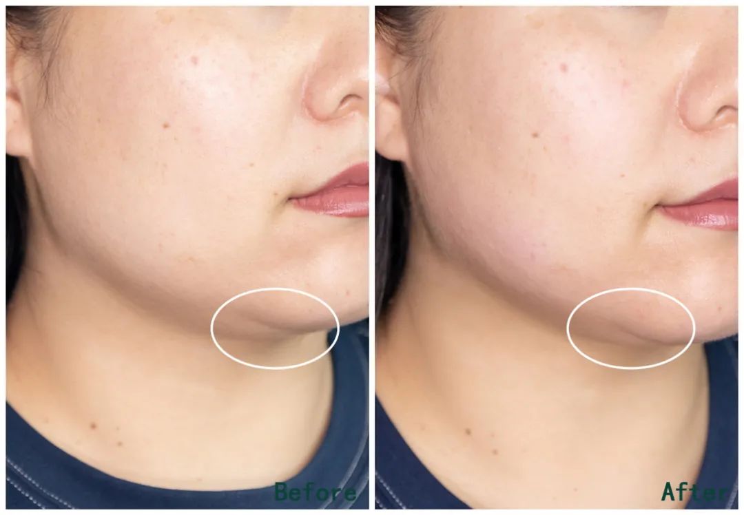 推广｜|下半年想买的第一个大件，我推荐它