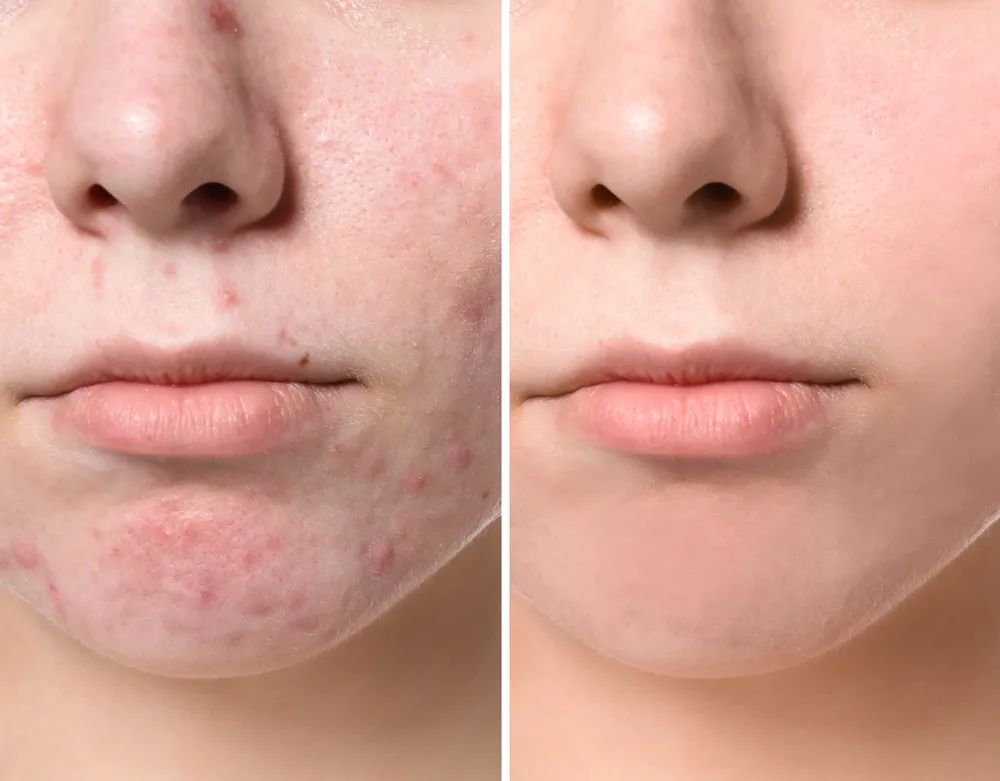 医美面膜是真好用还是智商税,被夸上天的网红爆款真的好用