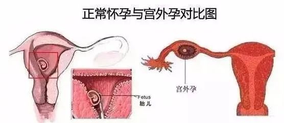 科普女性分娩危险,妇产疾病相关知识