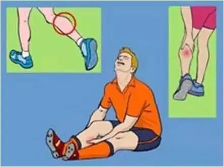 运动肌肉拉伤看哪个科,运动肌肉拉伤贴什么药