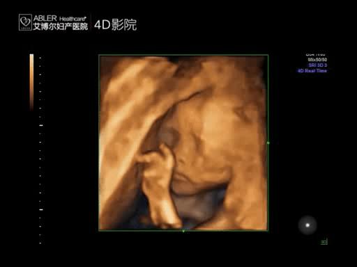 宁波北仑妇产医院排名,北仑产科哪个医院好