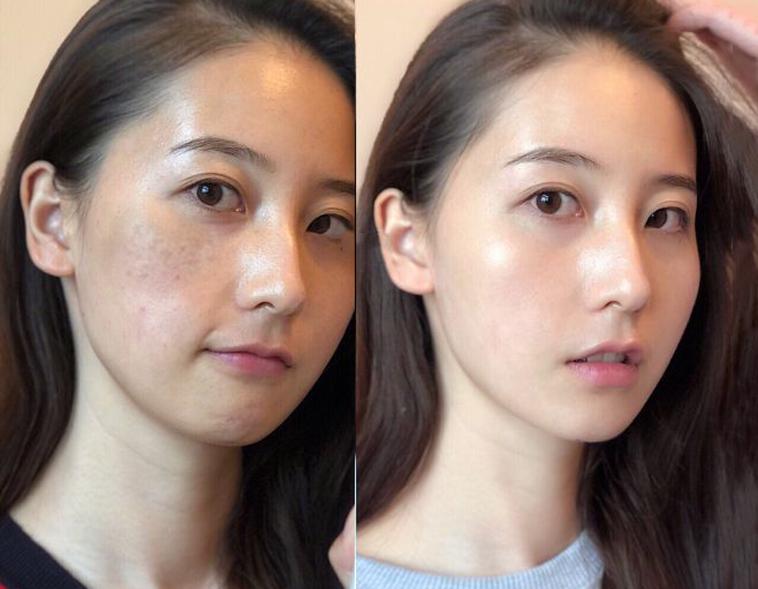 让脸上斑去掉,让脸上的皮肤变白