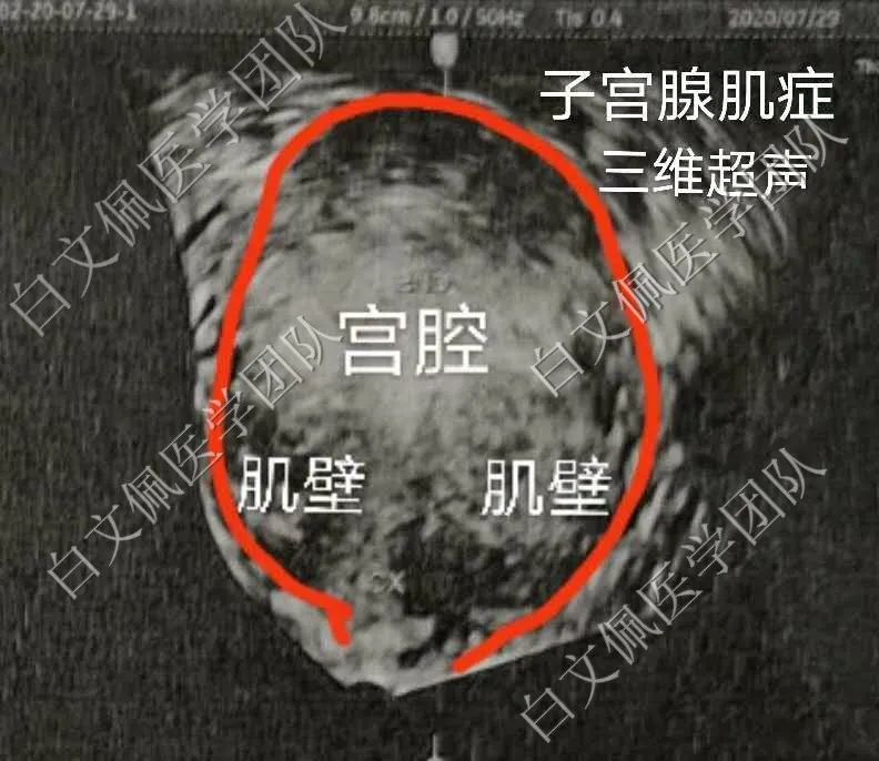 全彩人体解剖学图谱第二版,盆腔解剖学彩图教学视频