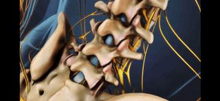 腰痛的真正原因是什么,腰痛要警惕五种原因