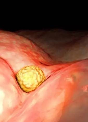 胎儿在子宫里是粘在子宫吗,宝宝在肚子里会无聊不