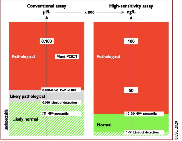 非st段抬高型心梗的治疗,非st抬高型心梗诊断标准