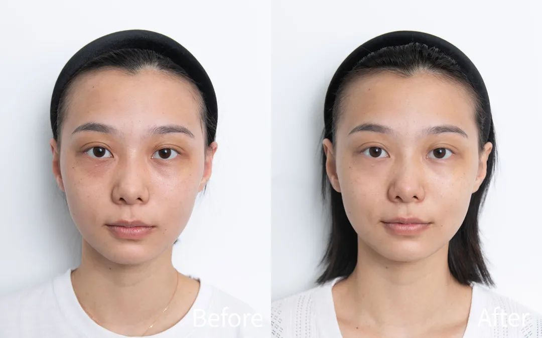 空瓶眼霜回购,无限回购的一款国货眼霜