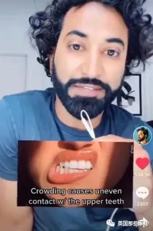 外网年轻人流行用指甲锉磨牙正畸,把正经牙医都急坏了