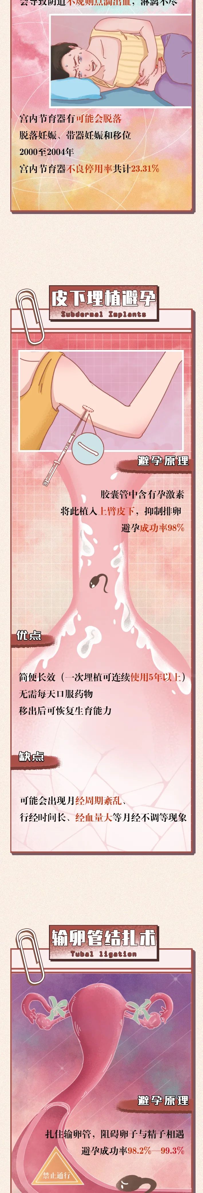 正确避孕的全过程，“第一次”之前必看