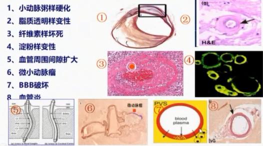 徐运神经内科,徐运医生怎么样