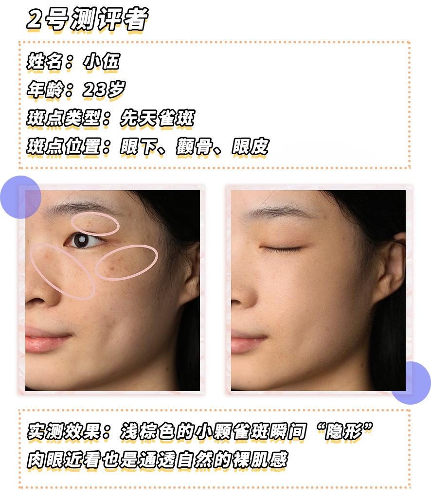 爱长斑的女人怎么办,女生长斑