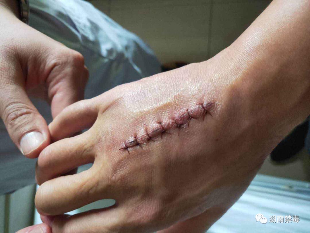 陈浩：“刀尖”上的禁毒硬汉！