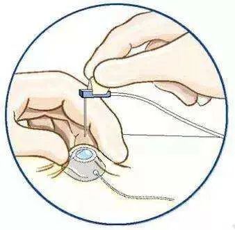 乳腺癌的相关问答,关于乳腺癌的科普知识脱口秀