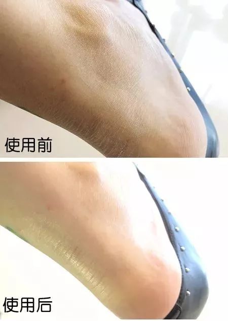 你穿高跟鞋经历过磨脚的痛苦吗,穿高跟鞋脚掌死皮怎么去除