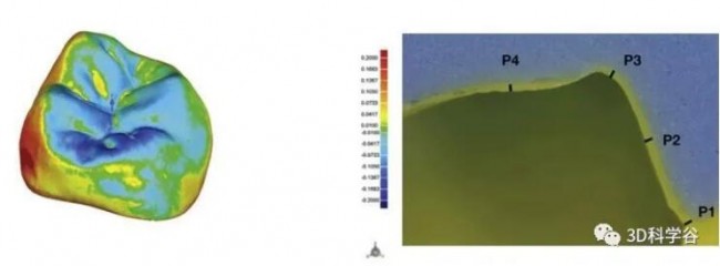 3D打印陶瓷牙冠可靠吗?请参考来自上海与欧洲口腔科研机构的研究