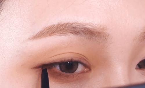 眼综合包含在眼综合吗,眼综合每个人都适合吗