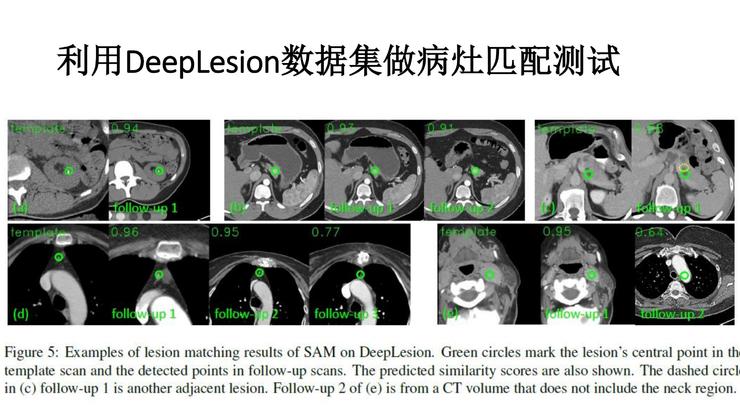陆菁菁北京协和医院,陆菁菁和睦家